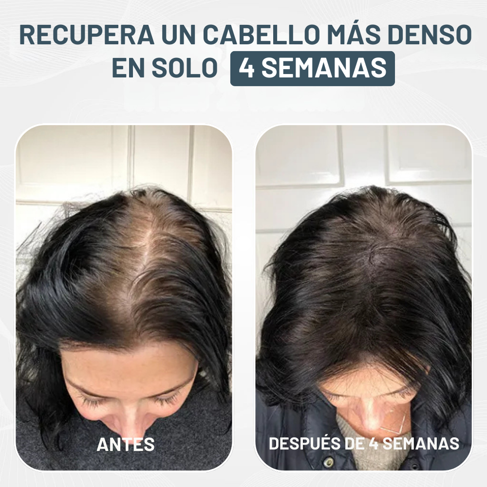 Kit de Microinfusión Miaxa™ Solución Capilar