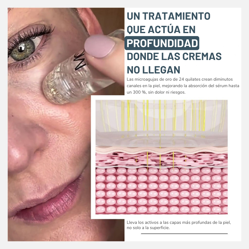 Kit de Microinfusión Miaxa™ Solución Antiedad