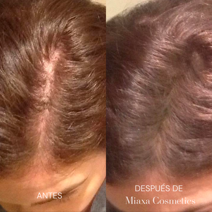 Kit de Microinfusión Miaxa™ Solución Capilar